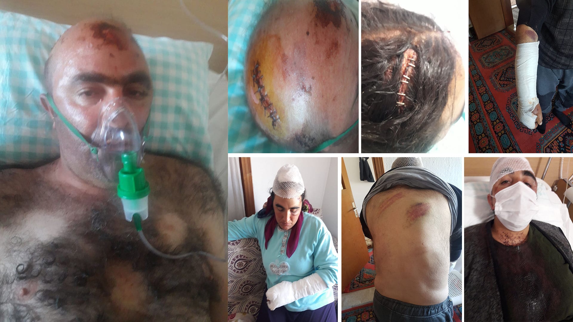 Malbata kurd qala êrîşa nijadperestan kir