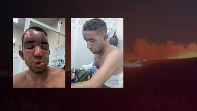 PAK: Îranê fosfora qedexekirî bikar anî
