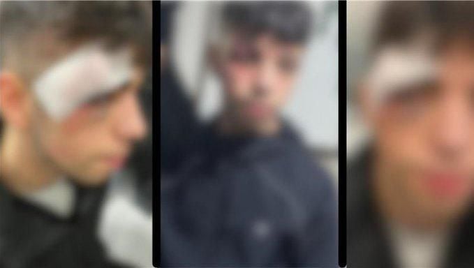 Polîsan lêdan, îşkence kirin û gotin ji derenceyê ketiye